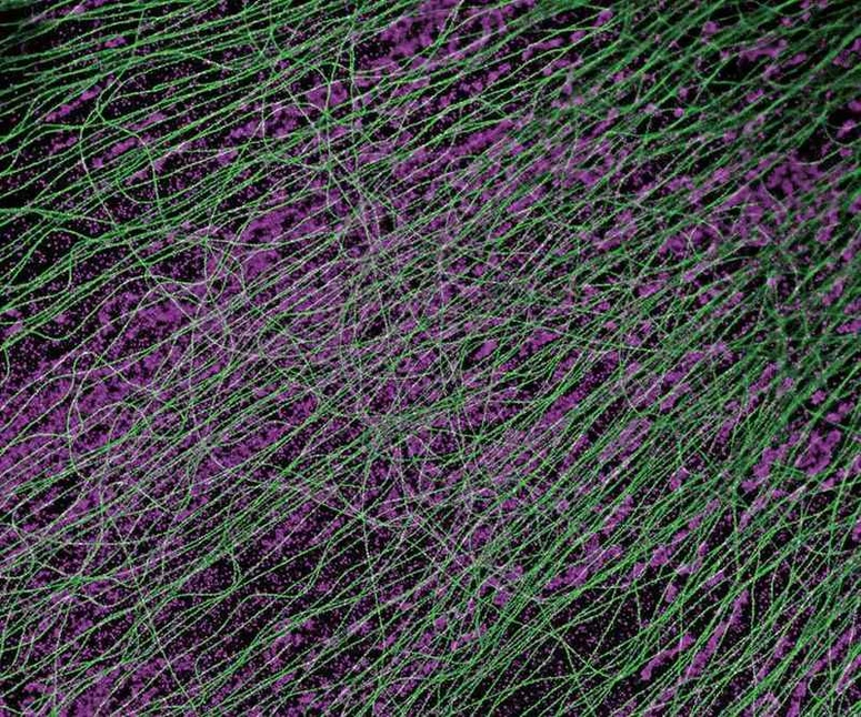 Altium International - Nikon Eclipse Ti2 - Obrázek super-rezoluce (DNA PAINT): Buňky CV-1 exprimující α-tubulin (zelený) a TOMM-20 (purpurový) zachycené objektivem CFI Apochromat TIRF 100XC Oil