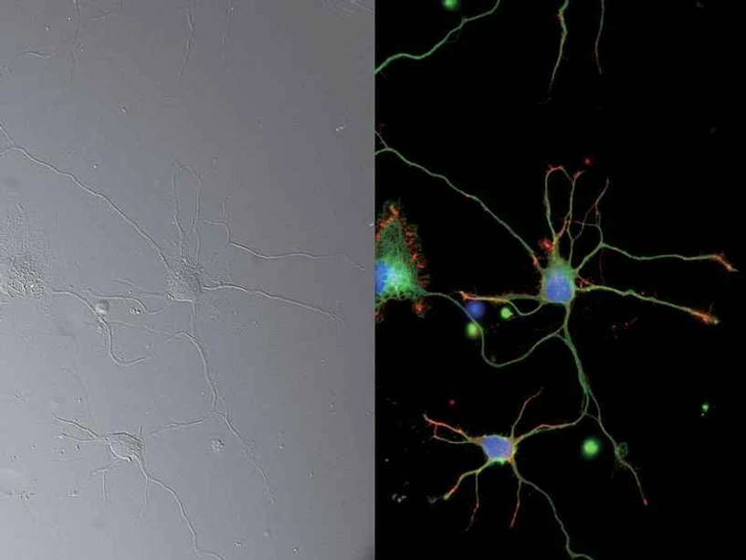 Altium International - Nikon Eclipse Ti2 - DIC a epi-fluorescenční snímky: snímek neuronů (DAPI, Alexa Fluor® 488, Rhodamin-Phalloidin) s 25mm FOV, pořízený objektivem CFI Plan Apochromat Lambda 60XC a kamerou DS-Qi2 Foto s laskavým svolením Josh Rappoport,  Imaging Center, Northwestern Univ . a S. Kemal, B. Wang a R. Vassar, Northwestern Univ, zdroj web Nikon.