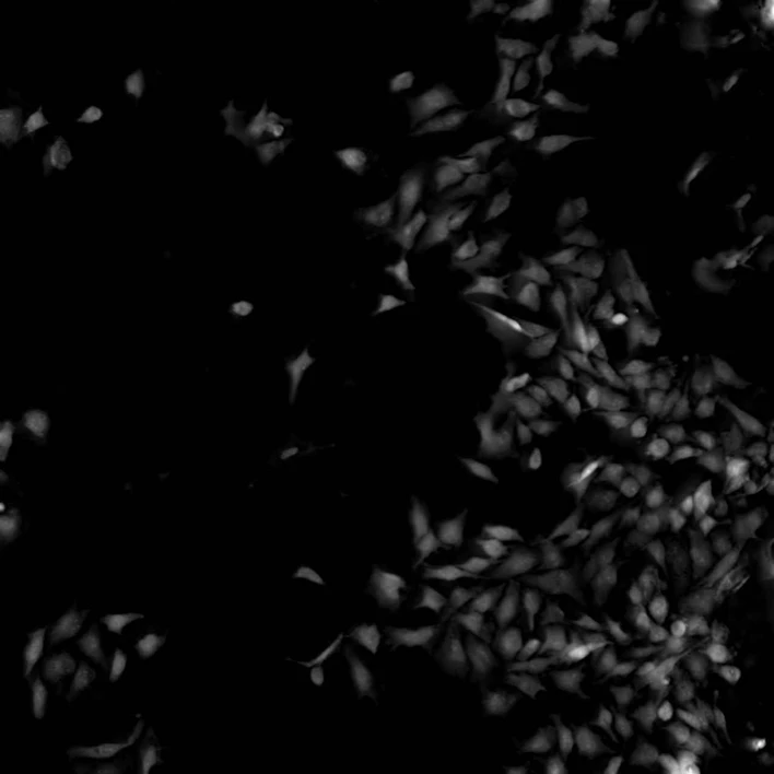 Altium International: Nikon Eclipse Ti2 - Volume Contrast HeLa buňky nasnímané s CFI S Plan Fluor ELWD 20XC