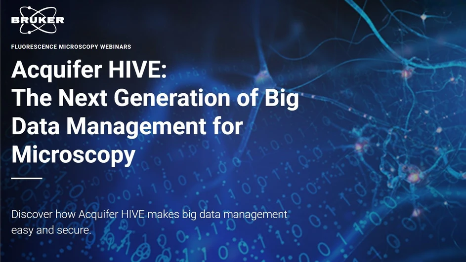 Bruker: Acquifer HIVE: The Next Generation of Big Data Management for Microscopy