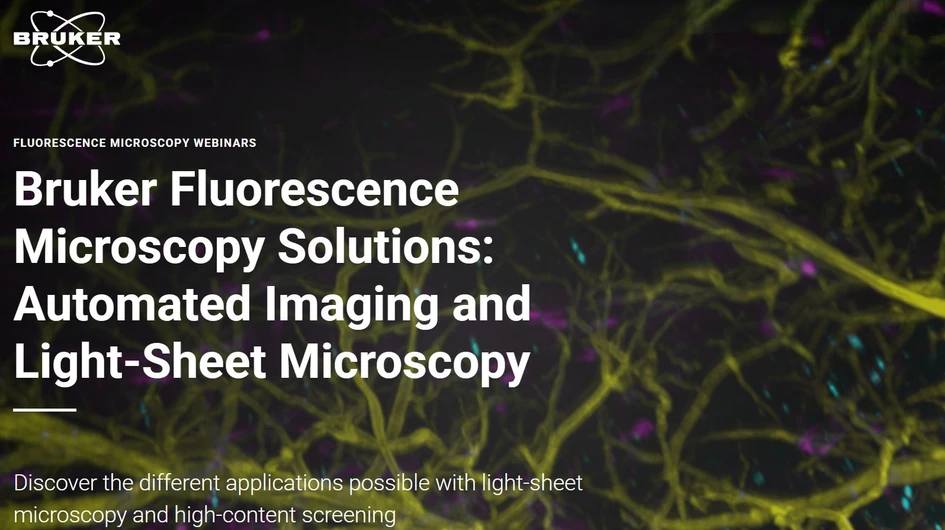 Bruker: Bruker Fluorescence Microscopy Solutions: Automated Imaging and Light-Sheet Microscopy