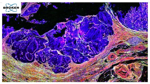MALDI Imaging Becomes IR-resistible: Going Multimodal for Advanced Biomedical Insights
