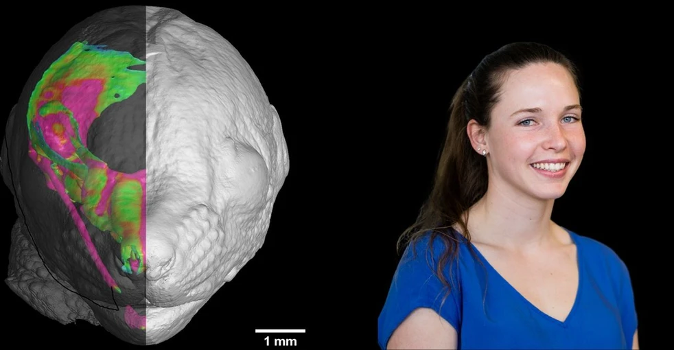 <ul>
<li><strong>Foto:</strong> CEITEC: Příjem bílkovin matky během těhotenství může ovlivnit vývoj obličeje novorozence</li>
</ul>
