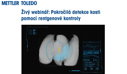 Pokročilá detekce kosti pomocí rentgenové kontroly