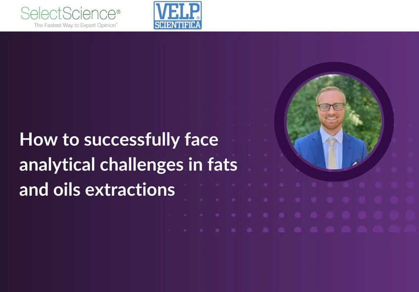 Select Science: How to successfully face analytical challenges in fats and oils extractions