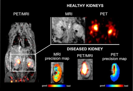 Nová PET/MRI kontrastní látka vyvinutá v ÚOCHB slibuje včasné odhalení skrytých nemocí