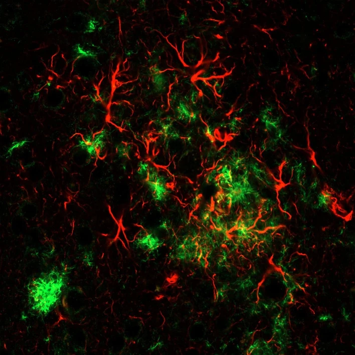 ÚOCHB AV ČR: Poklad v našich hlavách - jak Alzheimer krade bohatství mozku