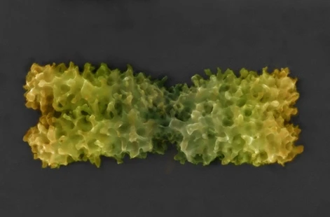 Čeští vědci jako první zobrazili povrchovou strukturu chromozomu – díky inovaci elektronové mikroskopie